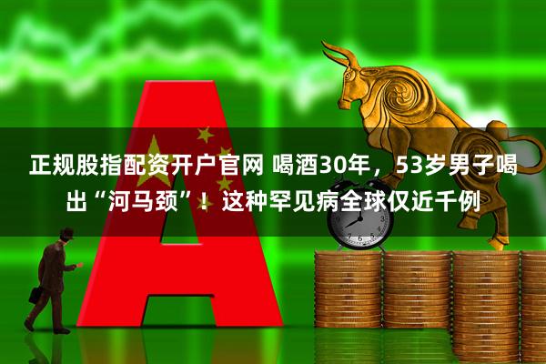 正规股指配资开户官网 喝酒30年，53岁男子喝出“河马颈”！这种罕见病全球仅近千例